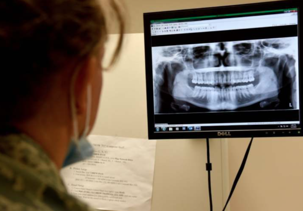 How are Federal Employees Covered by Dental Insurance?