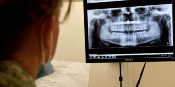 How are Federal Employees Covered by Dental Insurance?