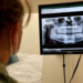 How are Federal Employees Covered by Dental Insurance?