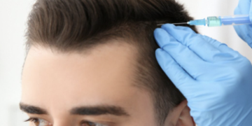 Hair surgery in Dubai