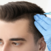 Hair surgery in Dubai