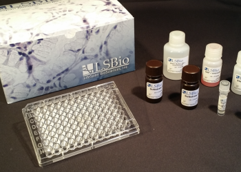 How to Obtain Optimal ELISA Results 7 Tips for Consistent, Accurate Measurements