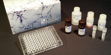 How to Obtain Optimal ELISA Results 7 Tips for Consistent, Accurate Measurements